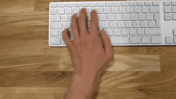 Provides example of Ulnar deviation of wrist while typing